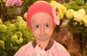 Мама умершей девочки-старушки из Винницы: Прости, что не смогла тебя спасти