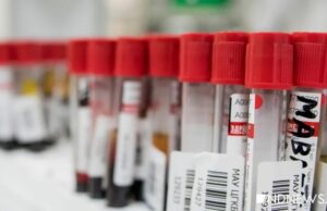 Британская лаборатория выдала 43 000 ложных отрицательных тестов на Covid-19