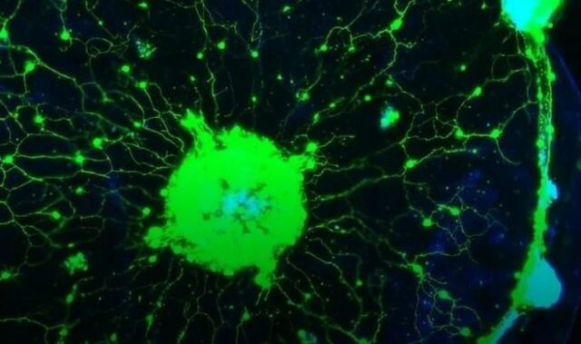 Ученые смогли увидеть работу несуществующего разума живой медузы