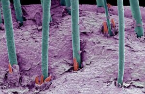 Биоинженеры dNovo научились выращивать на мышах волосы для пересадки людям