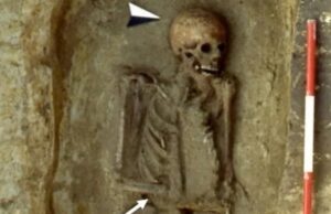 Средневековый итальянец заменил свою руку хитроумным ножом