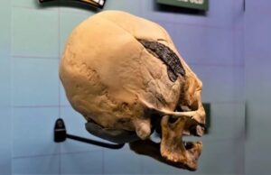 Перуанский череп со сложным металлическим имплантом вызвал споры ученых