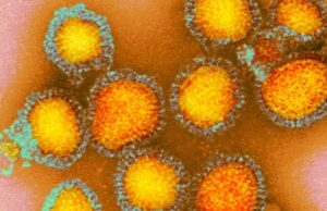 Загадочный «Русский грипп» XIX века, вероятно, был первой эпидемией коронавируса в мире