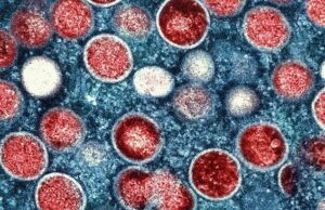 ВОЗ объявила вспышку обезьяньей оспы чрезвычайной ситуацией мирового значения