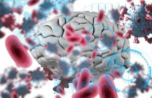 Перенесенный COVID значительно увеличивает риск развития деменции