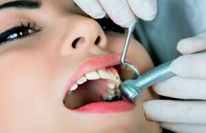 Пародонтоз — это что такое