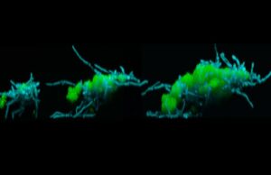 Вызывающий кариес суперорганизм научился перепрыгивать с зуба на зуб
