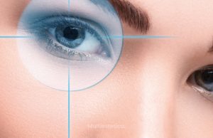 Коррекция зрения: при каких заболеваниях необходима