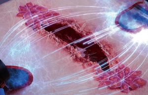 Электрическая стимуляция ускорит заживление ран в 3 раза