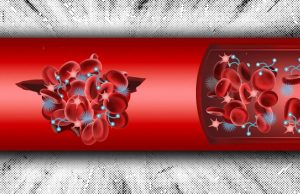 Инъекции синтетических тромбов помогут безопасно остановить кровотечение