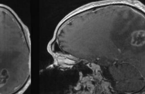 Особая диета запускает в раковых клетках механизм самоуничтожения