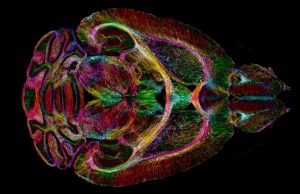 Ученые научились делать фантастически четкую МРТ мозга