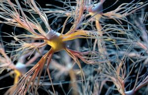 Пересадка способна заменить старые и больные клетки мозга на новые и здоровые