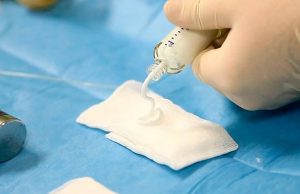 Российские ученые значительно улучшили состав «костного цемента»