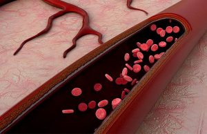 В Томске объявили о создании титановых кровеносных сосудов