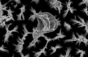 Титановые микрошипы способны уничтожать опасные бактерии без лекарств