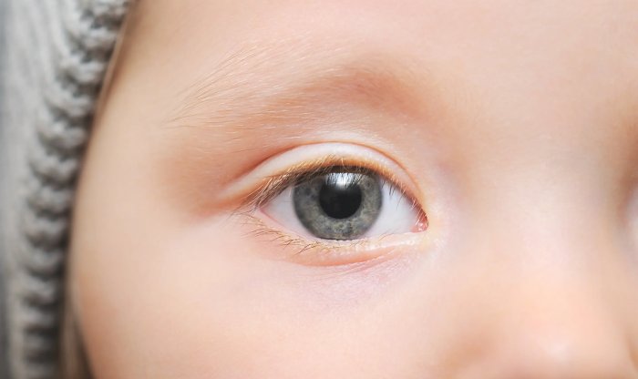 ИИ определит детский аутизм по снимкам глаз с точностью 100% 