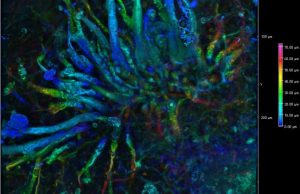 Старейший хищный гриб возрастом 407 млн лет был назван в честь Беатрикс Поттер