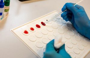 В России смогут определять сепсис всего за одни сутки