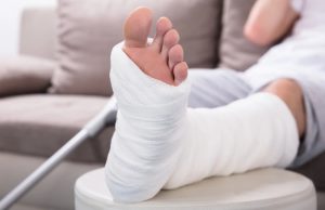 Пьезоэлектрический «костный бандаж» значительно ускоряет срастание костей