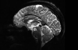 Самый мощный в мире МРТ-аппарат Iseult в несколько раз превзошел конкурентов