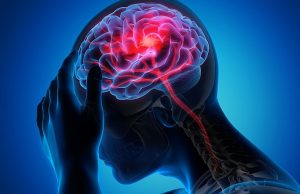 Стремительные изменения климата резко увеличили количество инсультов