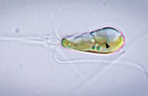 Редчайший случай в эволюции – две формы жизни слились в единое целое