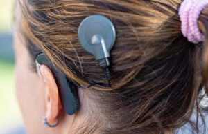 Имплантируемый микрофон UmboMic позволит отказаться от внешних слуховых аппаратов