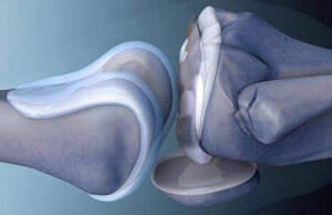 В Кабардино-Балкарии активно осваивают трехмерную биопечать имплантов