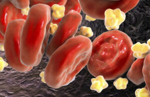 Комбинация двух препаратов снижает уровень холестерина в крови на 49 %