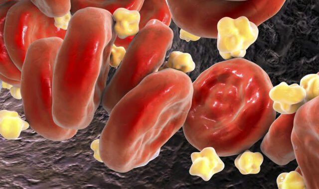 Комбинация двух препаратов снижает уровень холестерина в крови на 49 %