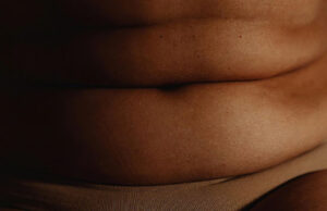 Один укол препарата MariTide от Amgen в месяц снижает вес на 16 процентов