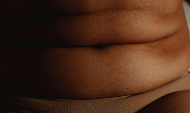 Один укол препарата MariTide от Amgen в месяц снижает вес на 16 процентов