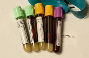 В Стэнфорде разработали анализ крови для определения скорости старения отдельных органов