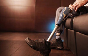 В России впервые провели имплантацию модульного эндопротеза