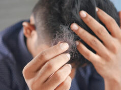 В США завершаются испытания первой эффективной таблетки от облысения