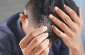 В США завершаются испытания первой эффективной таблетки от облысения