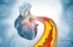 Одноразовая генная терапия навсегда снизит количество липидов в крови